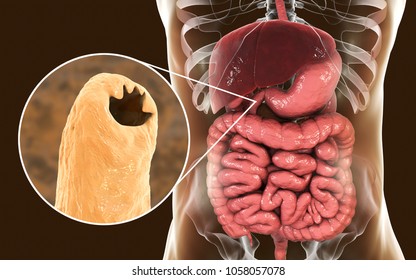 Parasite Infestation Images, Stock Photos & Vectors | Shutterstock