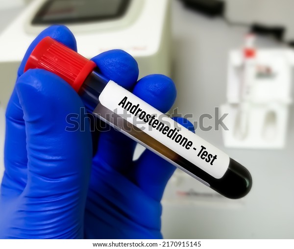 androstenedione-testing-used-evaluate-function-adrenal-stock-photo