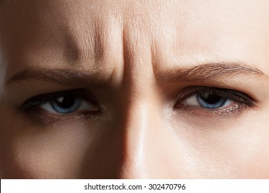 Angry Face Of A Young Woman With Facial Wrinkles Closeup