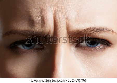 Angry face of a young woman with facial wrinkles closeup
