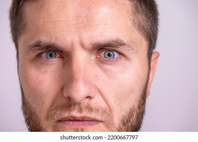 Angry, Nervous, Doubtful, Unhappy, Frustrated Man Frowning His Eyebrows. Annoyed Closeup Face Portrait.