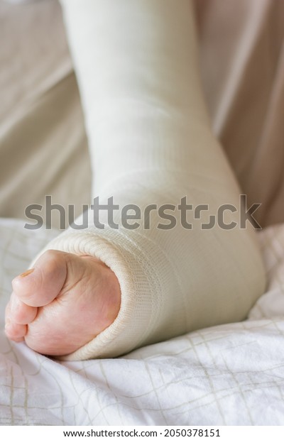 Ankle Cast On Elderly Person Fracture Stock Photo 2050378151 | Shutterstock