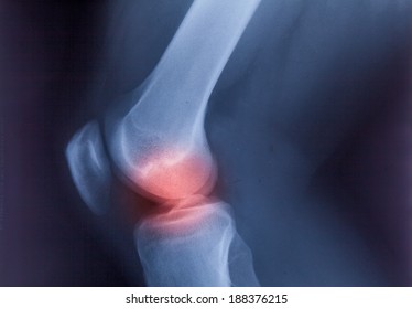 Ankle feet & knee joint X-ray photo film 