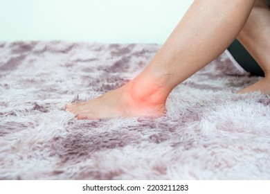 Ankle Inflammation Of The Human Foot Bones