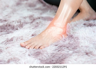 Ankle Inflammation Of The Human Foot Bones