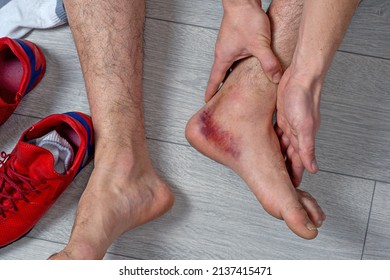 Ankle Injury With Dislocation And Sprains. Fracture Or Leg Sprain Injury Of Young Sports Man. 