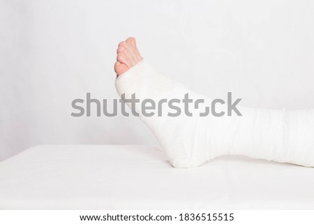 Ankle wound with a bandage in a tight fixing bandage on a white background. Concept of leg fracture and plaster bandage, hospital