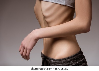 Anorexia. Girl Shows Thin Stomach And Ribs Close-up