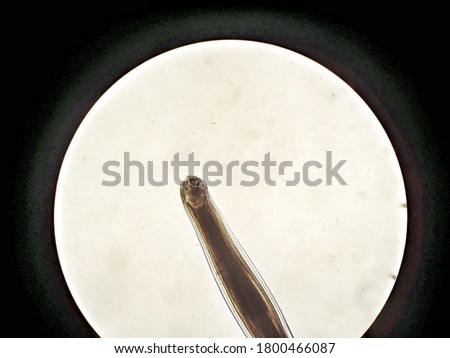 anterior hookworm from cat under microscope