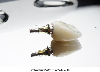 anterior implant crown with custom abutment - Shutterstock ID 1291870768