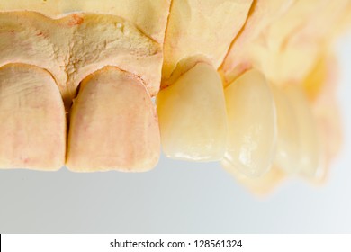 54 Anterior Teeth Aesthetics Images, Stock Photos & Vectors | Shutterstock