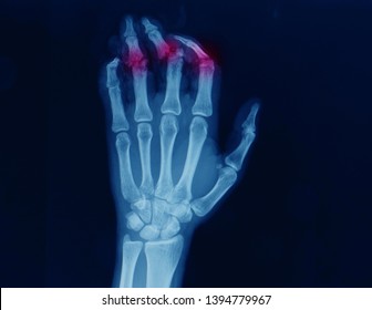 Skeleton Middle Finger Images, Stock Photos & Vectors | Shutterstock