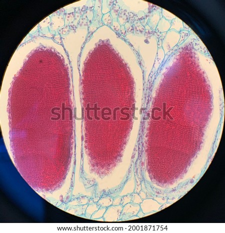 Antheridium or female reproductive part of Marchantia species observe under 400X magnification  Stock photo © 
