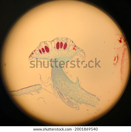 Antheridium of Marchantia species observe under 4x magnification  Stock photo © 