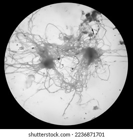 Anthropophilic dermatophyte fungus, causes infections of scalp (tinea capitis), body skin (tinea corporis) mainly in children. Micrograph - Shutterstock ID 2236871701