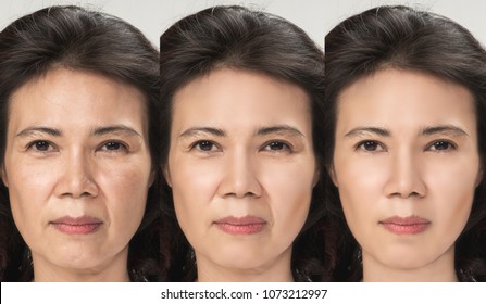 Anti Aging Process, Asian Woman Face Skin With Anti-aging Procedures, Rejuvenation, Lifting, Tightening Of Facial Skin, Restoration Of Youthful Skin Anti-wrinkle. Old And Young Concept.