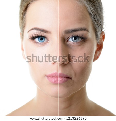 Anti-aging, beauty treatment, aging and youth, lifting, skincare, plastic surgery concept. Beautiful girl with young face and half face of old woman with wrinkles, dark circles, acne and comedones.