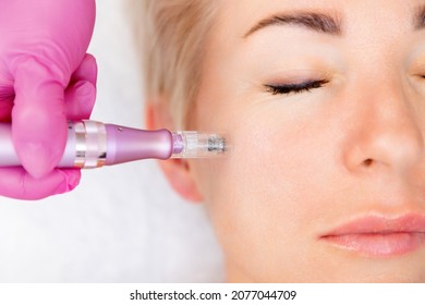 Anti-aging treatment and face lift. Close upportrait of adult woman at a mesotherapy procedure in cosmetology clinic. Top view.