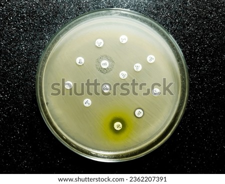 Antibiotic susceptibility testing, antibiotic resistance test.