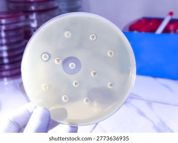 Antibiotic susceptibility testing, Antibiotic sensitivity testing.