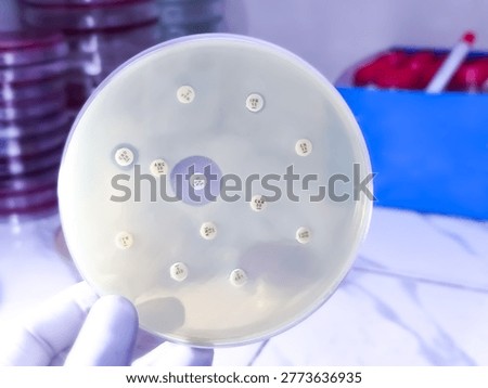 Antibiotic susceptibility testing, Antibiotic sensitivity testing.