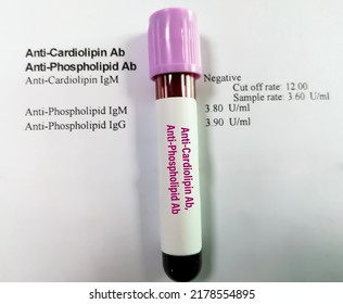 Anti-Cardiolipin Ab And Anti-Phospholipid Ab Test, Autoimmune Disorder Diagnosis.