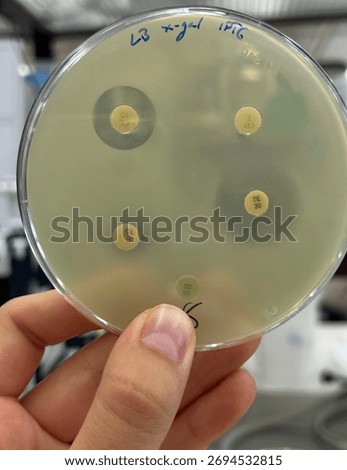 Antimicrobial susceptibility test by diffusion disc method on agar 