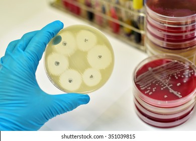 Antimicrobial Susceptibility Testing In Culture Plate
