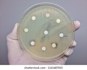 Antimicrobial Susceptibility Testing is The goals of testing to detect drug resistance in pathogens. - Shutterstock ID 1161687055