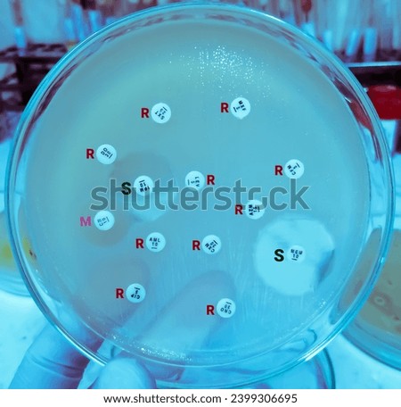 Antimicrobial susceptibility testing in petri dish, here R= Resistance, S= Sensitive and M= Modarate. Stock fotó © 