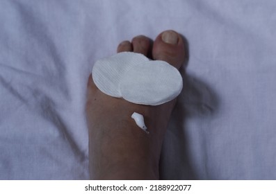 Antiseptic Cream On The Foot Isolated Background