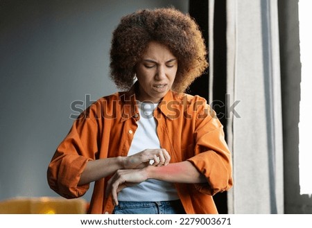 Anxious young African American woman self harming while scratching her hand, feeling annoying itching. Skin allergic reaction. Allergology. Dermatology. Skin problems. Health and medicine concept