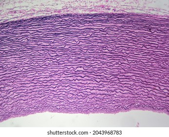 Aorta From Primate Showing Elastic Connective Tissue (100x)