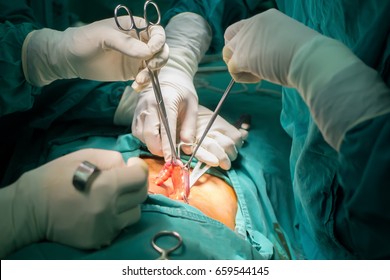 Appendectomy surgery procedure with small incision by surgery doctor. Step by step.Operative Procedure in operating room
