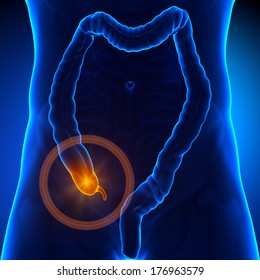Appendix pain