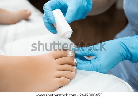 Application of antibiotic powder on toenails by podologist in the clinic. 
