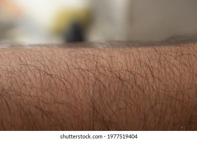 Approximate Image Of Arm Hair