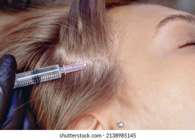 An Approximate Photography Injecting Medication Into The Female's Scalp For The Purpose Of Hair Mesotherapy.