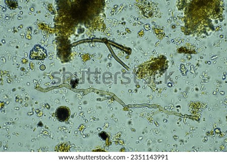 arcella, fungi and nematode in a soil sample on a farm in australia 