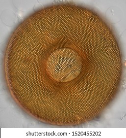 Arcella, Shell Of Single Celled Amoeboid Protist.  Organic Wall With Honeycomb Texture.  When Occupied, The Amoeba Extends Pseudopodia Through The Central Aperture To Feed And Move. Light Micrograph.