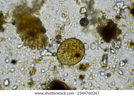 arcella testate amoebae under the microscope from a soil sample on a farm. a living soil on a regenerative agricultural farm Foto stock © 