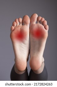 Arch Pain, Inflammation, Overuse, Plantar Fascia Injury. Foot With Red Points. High Quality Photo