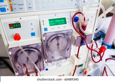 Arlificial Kidney (dialysis) Device With Rotating Pumps. Closeup View.