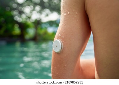 An Arm Of A Diabetes Patient Against A Swimming Pool With A Waterproof CGM (Continuous Glucose Monitor)