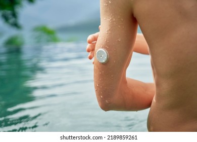 An Arm Of A Diabetes Patient Against A Swimming Pool With A Waterproof CGM (Continuous Glucose Monitor)