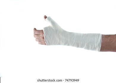 Arm In Plaster Cast