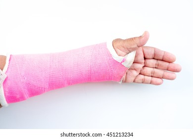 Arm Splint, Be In Plaster Cast