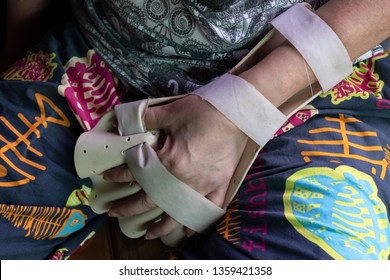 Arm Splint For Treatment