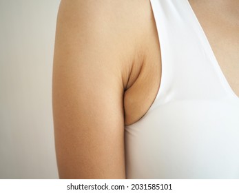 Armpit Fat At Young Woman Between 30-40 Years Old Dressed In A Sporty  Bra. Closeup Photo, Blurred.