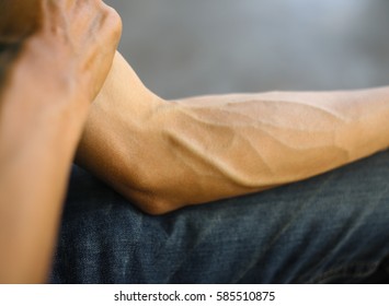 Arms full of tendons, Tendons on the forearm